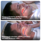 Smart Anti-Snoring EMS Sleep Device